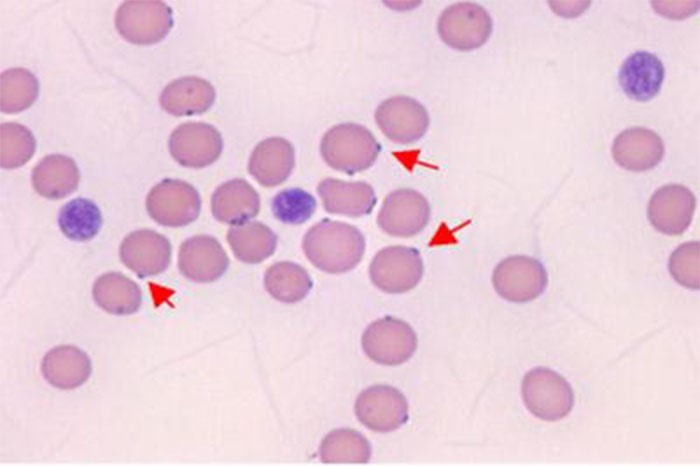 Kedilerde Hemobartonellosis